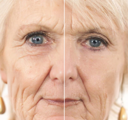 Eyesential under eye enhancer customer results